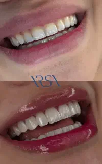تخفیف افتتاحیه با قیمت استثنایی