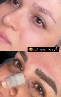تخفیف ۱میلیونی ریمووتاتو/شیدینگ لب/بنمژه/میکروابرو