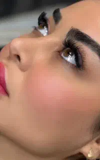 اموزش بوتاکس/ژل/مزو فقط با۲تومن ژل از سیسی۲۰۰داریم