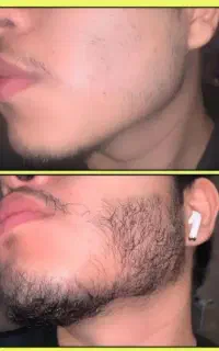 ریشه قوی تار قوی