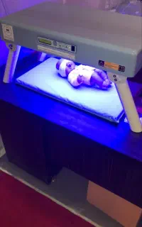 دستگاه زردی نوزاد در گنبد کاووس