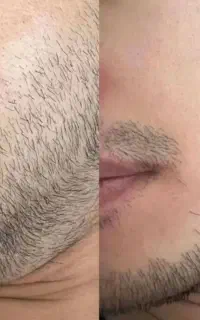 کوسه نباش مرد