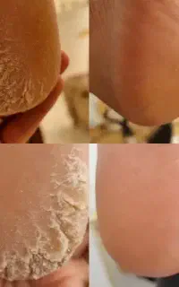 خدمات کفسابی و پدیکور