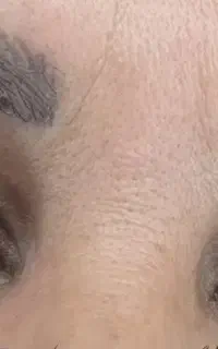 اکستنشن مژه