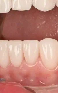 دندانپزشکی تخصصی با ضامنت /اقساطی/وام پزشکی تبریز