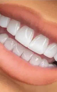 عصب کشی ۱۴۰۰ روکش ۴ کامپوزیت ۵ لمینت ۷ ایمپلنت
