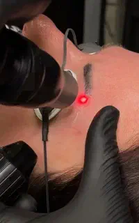 جشنواره پاک کردن تتو صورت وبدن بدون آسیب