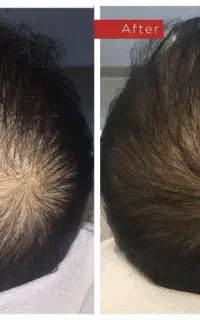 نتیجه گیری فقط تو دوماه