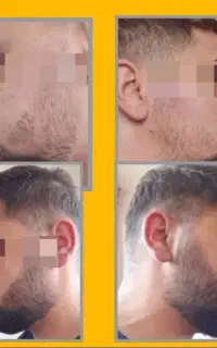 ابزار رشد برای رشد ریش