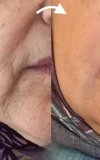کرم بیوممتیک ۱۲ کاره برای لیفت پوست و جوانسازی