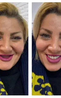 دندانسازی/دندان مصنوعی/بامجوزرسمی و ۸۰سال سابقه