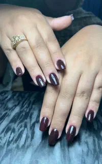 ژلیش،کاشت اولیه،ترمیم،ریمو