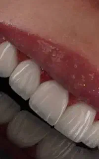 دندانپزشکی تخصصی ، ایمپلنت ، اوردنچر
