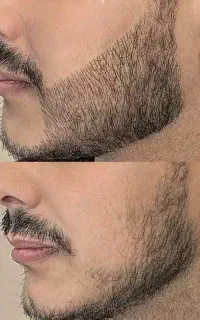 معجزه گر