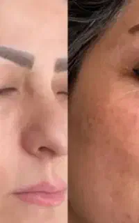 پک ۳عددی صابون روشن کننده و لایه بردار دکتر بیز