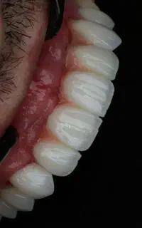 مرکز تخصصی دندانپزشکی و ایمپلنت اقساط بلند مدت