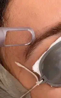 ریموو تاتو ابرو و بدن دستگاه اورجینال تست رایگان