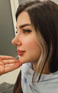 تخفیف زیبایی بینی ۲۸ت دراهوازتااخرماه فقط