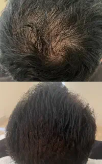 تار موهاتو دوباره میتونی پرقدرت ببینی