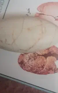 سنگ الماس