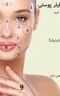تزریق فیلر ژل وبوتاکس