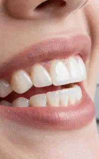 آموزش کامپوزیت