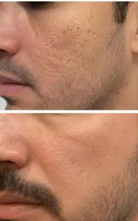 با سلول های بنیادی از بنیاد تغییر کن
