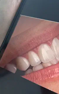 تخفیف ویژه دندانپزشکی به مدت یک ماه