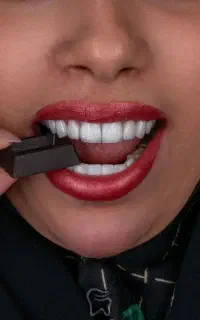 ونیر دندانپزشکی لمینت کامپوزیت کاشت ایمپلنت