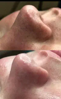 پاکسازی، فیشیال، کربوکسی، پارافین، پدیکور