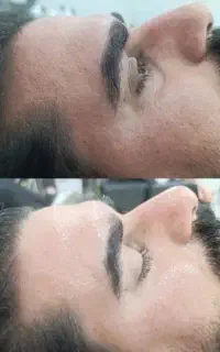 پاکسازی پوست ۵۰۰