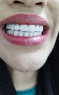 دفترچه دندانپزشکی پارسیان بگیرید