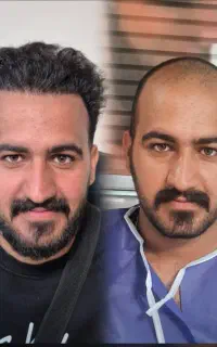 جشنواره کاشت موشیرازی باضمانت۱۰میلیون فول تراکمvip