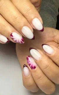 کاشت ناخن ترمیم