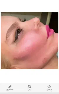 زیبایی ژل و بوتاکس کاشت ابرو