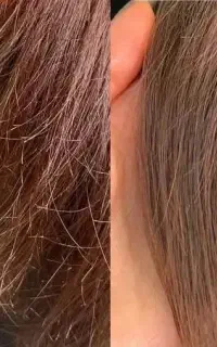 خدمات موخوره گیری vip