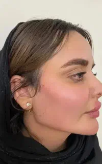 تخصصی ترین مرکز ژل و بوتاکس  ومزو تراپی