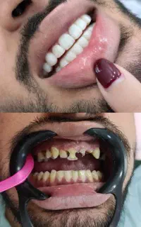آموزش لبه شیشه و کامپوزیت