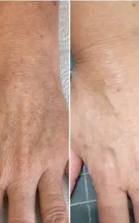 پاک کننده کک مگ.تنگ ی و اژَ ن. سو ال آ یین  نامه