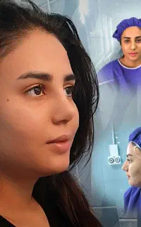جراحی بینی با۴۲میلیون/ویژه شهروندان مهاباد درتهران