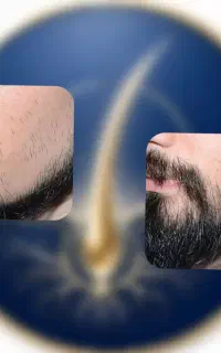 ریش و موهات پرپشت میشه با این محصول