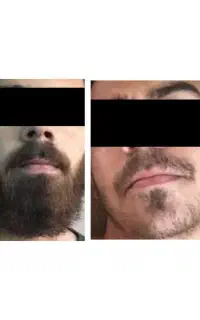 یه ریش پر پشت سهم توعه