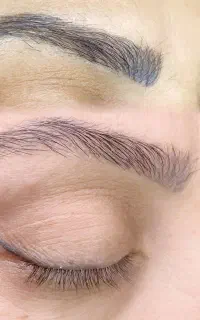 ریموو تاتوهای قدیمی