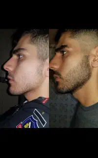 ریشات برات مهمه