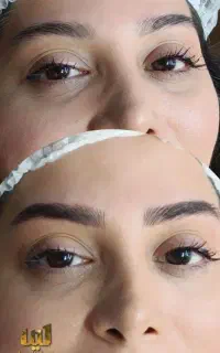 انواع خدمات میکروبلیدینگ شیدینگ لب خط چشم