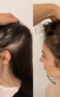 این اخرین روشیه که امتحان میکنی