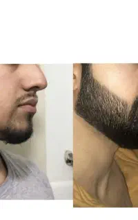روغن و ... بذار کنار متد۲۰ روزه تضمینی آوردم برات
