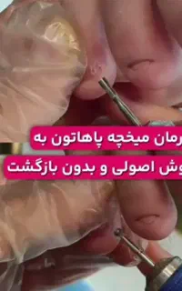 درمان و اموزش پیشرفته آسیب پا