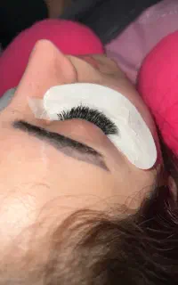 کاشت مژه