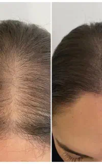 تخفیف ویژه خدمات زیبایی